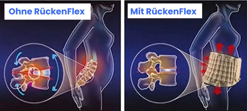 RückenFlex™ | Eliminiert Rückenschmerzen in 10 Minuten!